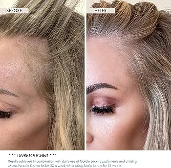 Goldie Locks Review: Salon-Grade Haircare That Delivers Real Results